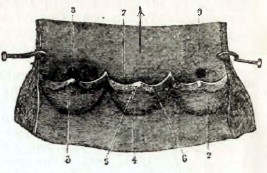 Рис. 28. - Полулунные клапаны аорты